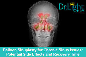 Balloon Sinuplasty